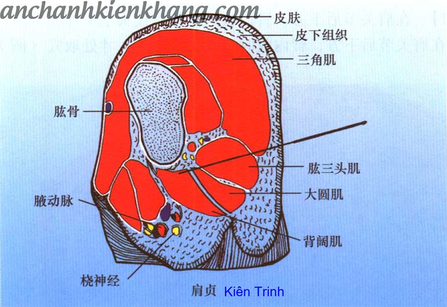 châm cứu huyệt kiên trinh